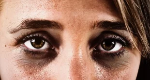 Cara Menghilangkan Mata Panda Secara Alami